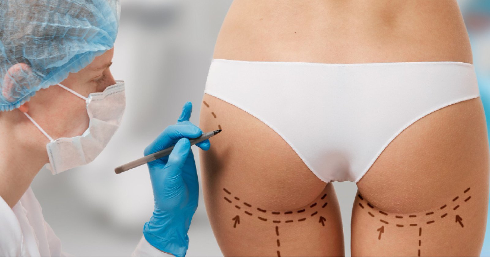 Best Cosmetic Surgeon In Bangalore